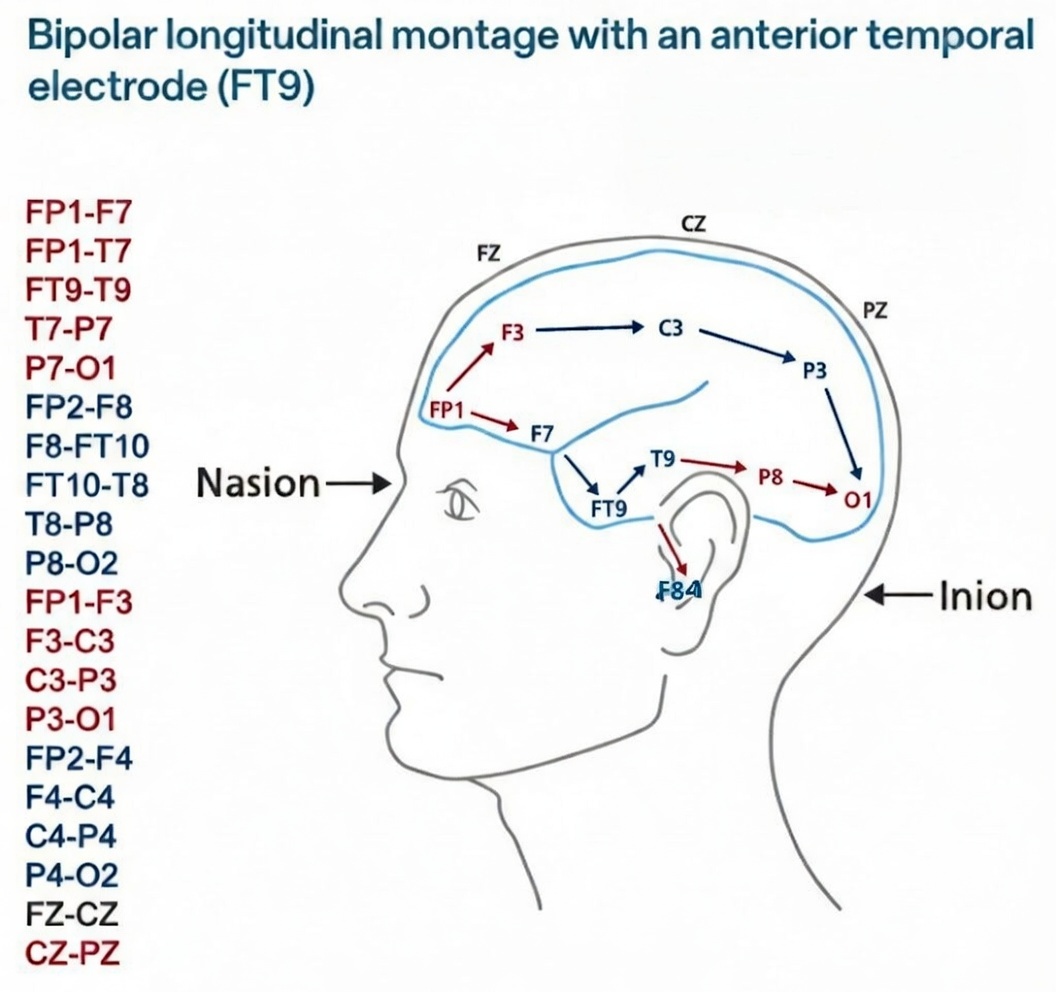 الکترود تمپورال