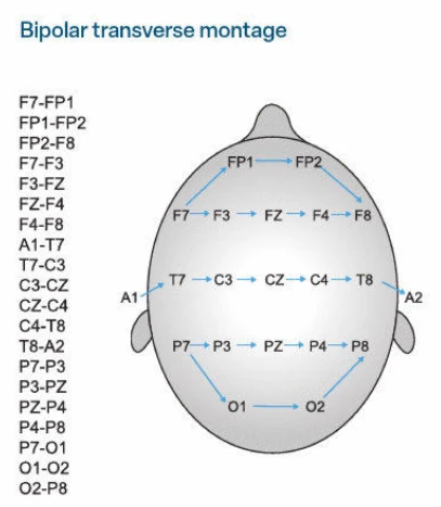 دوقطبی عرضی