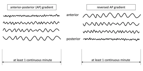 AP Gradient