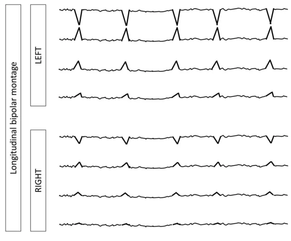 Unilateral Independent Periodic Discharges