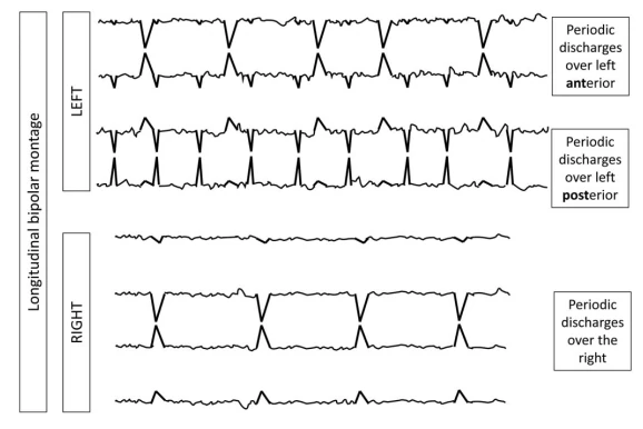 GPDs with Fast Activity