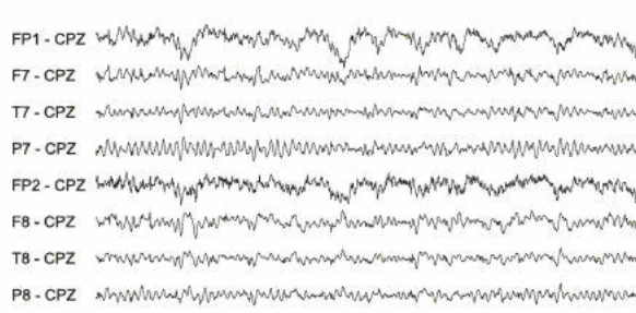 ترمور پالاتال