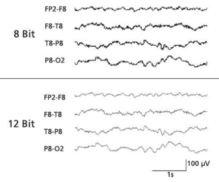 تفاوت رزولوشن