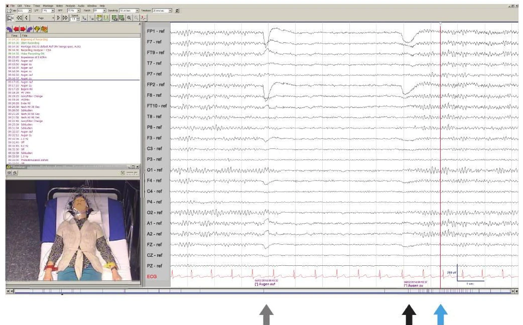 ثبت ویدیویی