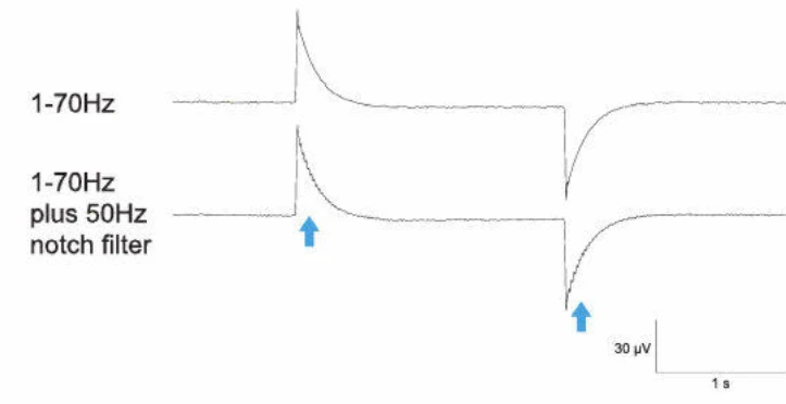 آرتیفکت رینگینگ