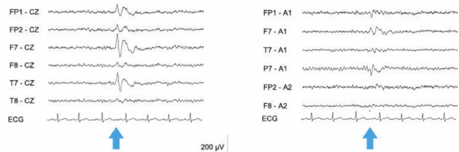 مقایسه مونتاژها