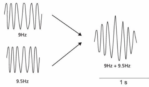 ریتم‌های EEG