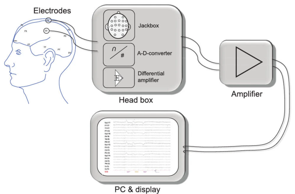 اجزای سخت‌افزاری EEG