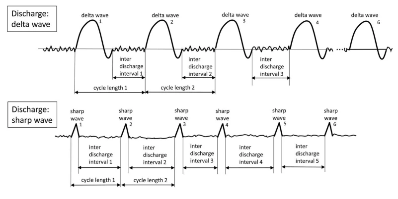 LPDs with Fast Activity