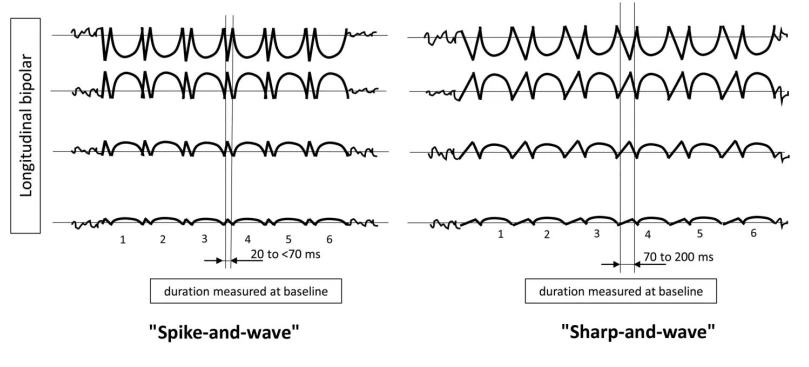 BIPDs with Fast Activity