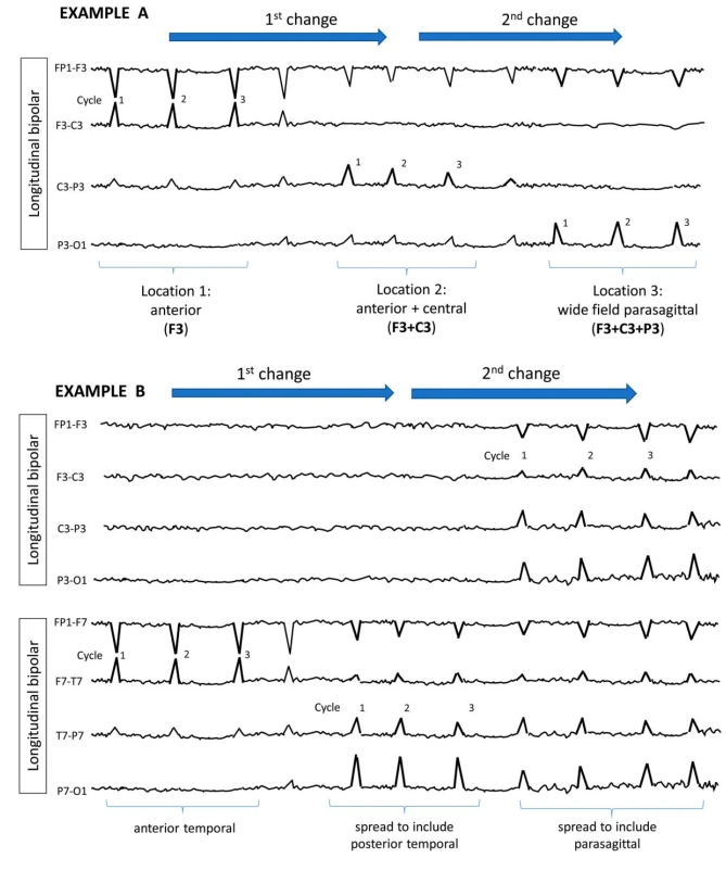 Frequency Fluctuation