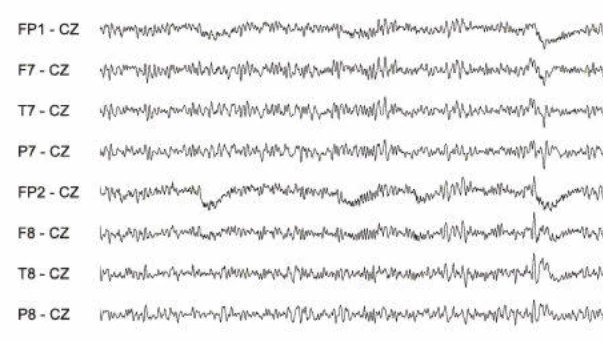 نمایش اسپایک‌ها در مونتاژهای مختلف