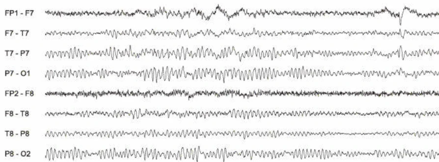 اسپایک‌ها، تمپورال چپ و راست