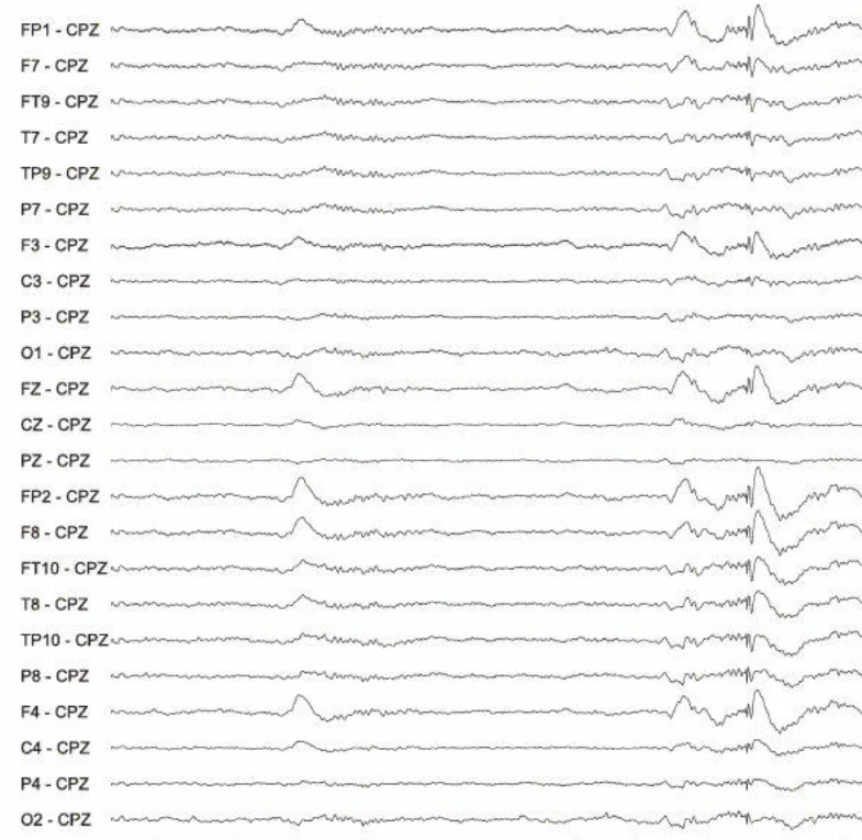 پلی‌اسپایک-ویوها، ژنرالیزه