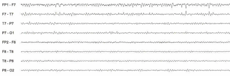 تغییرات جراحی