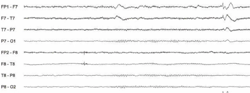 نمونه تاریخچه بالینی و طبقه‌بندی