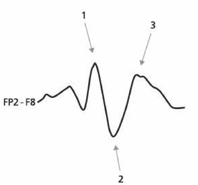 امواج تری‌فازیک