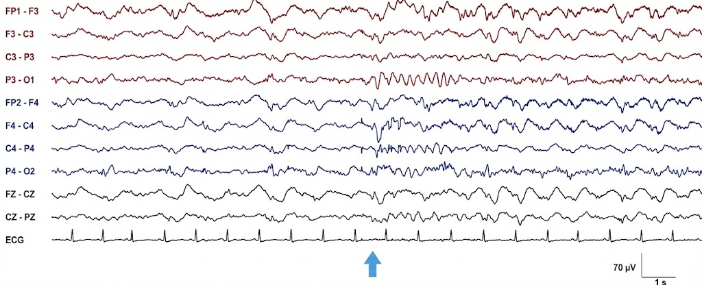 پاسخ طبیعی به محرک