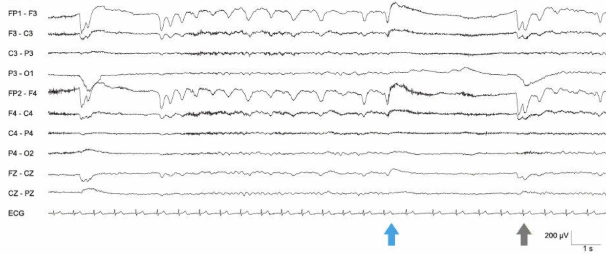 کندی پس‌زمینه