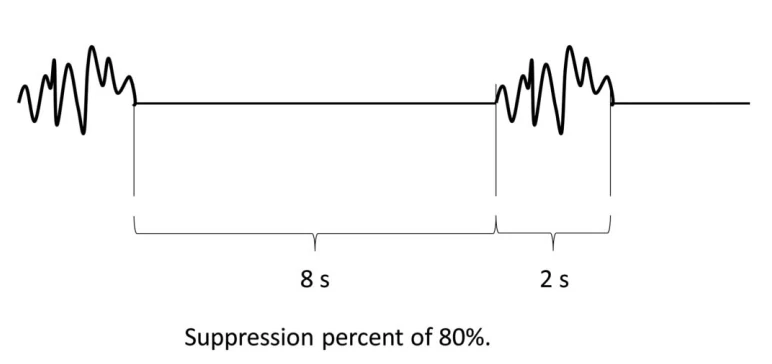 EEG Symmetry