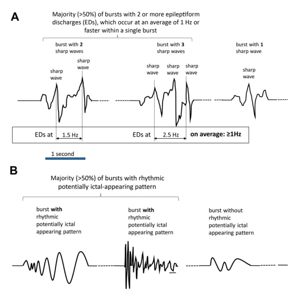 EEG Asymmetry