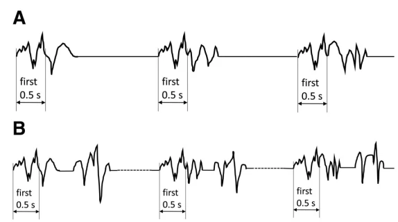 EEG Continuity